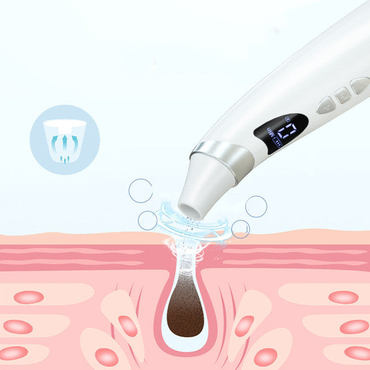 Smart Visual Blackhead Remover – Deep Pore Cleansing & Suction Tool