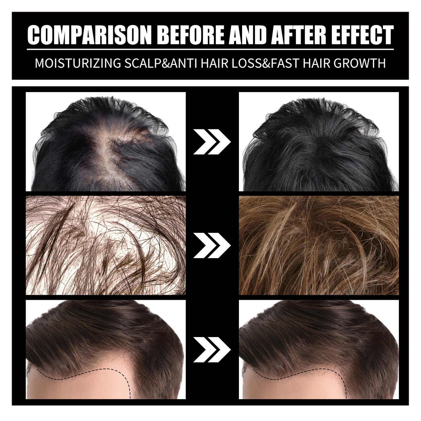 Biotin & Collagen Hair Growth Drops – Advanced Liquid Formula for Stronger Hair, Radiant Skin & Healthy Nails